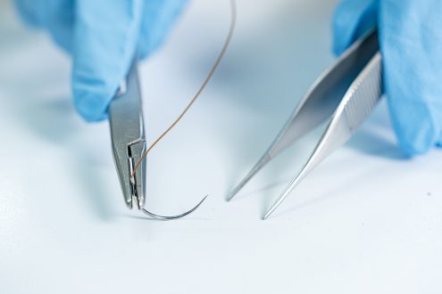 Ambulante Chirurgie in der Praxis